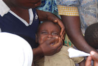 A mother holds her baby who has an eye infection